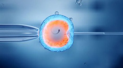 二代试管短方案促排期间注意什么