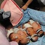 详细解读峨眉山市做长方案试管婴儿费用，长方案和短方案成功率有差别吗？