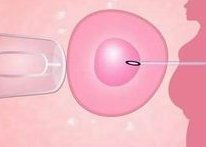 孕泰国际试管谁听谁怀孕：2017试管前端技术交流暨中泰顾问咨询会